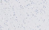 Anti-TPH-1 Antibody, clone 3J7 ZooMAb Rabbit Monoclonal 