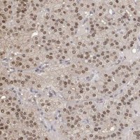 Anti-TPI1 antibody produced in rabbit 
