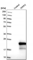 Anti-TPPP2 antibody produced in rabbit 
