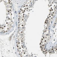 Anti-TPX2 antibody produced in rabbit 