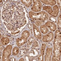 Anti-TRAPPC4 antibody produced in rabbit 