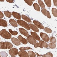 Anti-TRDN antibody produced in rabbit 