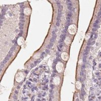 Anti-TREH antibody produced in rabbit 
