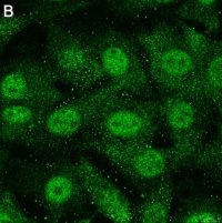 Anti-Treslin Antibody, clone 5L19 ZooMAb Rabbit Monoclonal 