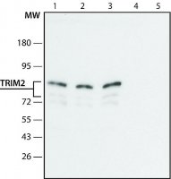 Anti-TRIM2 (C-terminal region) antibody produced in rabbit 