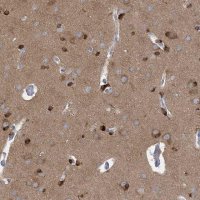 Anti-TRIM2 antibody produced in rabbit 