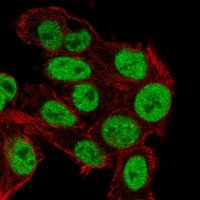 Anti-TRIM24 antibody produced in rabbit 