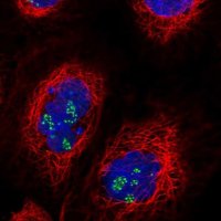 Anti-TRIM27 antibody produced in rabbit 