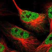 Anti-TRIM35 antibody produced in rabbit 