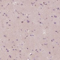 Anti-TRIM69 antibody produced in rabbit HPA028894-100UL
