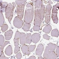 Anti-TRIM72 antibody produced in rabbit 