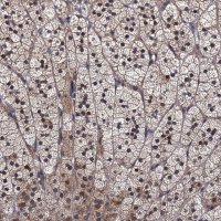 Anti-TRMT112 antibody produced in rabbit 