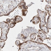 Anti-TRMT1L antibody produced in rabbit 