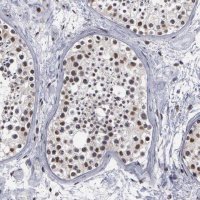 Anti-TRMT5 antibody produced in rabbit 