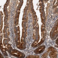 Anti-TRMT61B antibody produced in rabbit 