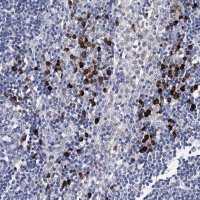 Anti-TRPM2 antibody produced in rabbit 