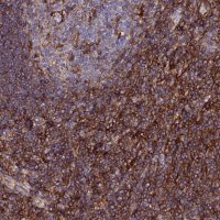 Anti-TRPV2 antibody produced in rabbit 