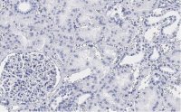 Anti-TSC2 Antibody, clone 4H10 ZooMAb Rabbit Monoclonal 