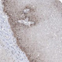 Anti-TSEN15 antibody produced in rabbit HPA029237-100UL