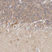 Anti-TSEN2 antibody produced in rabbit 