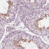 Anti-TSKS antibody produced in rabbit 