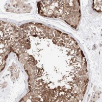 Anti-TSNAX antibody produced in rabbit HPA031055-100UL