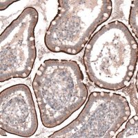 Anti-TSPAN13 antibody produced in rabbit 