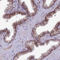 Anti-TSPAN15 antibody produced in rabbit 