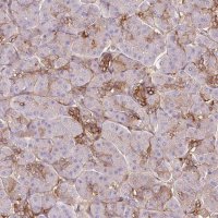 Anti-TSPAN8 antibody produced in rabbit 