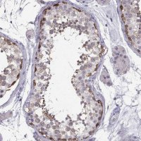 Anti-TSPYL5 antibody produced in rabbit 