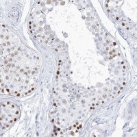 Anti-TSPYL6 antibody produced in rabbit 