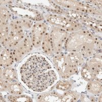 Anti-TSTD2 antibody produced in rabbit 