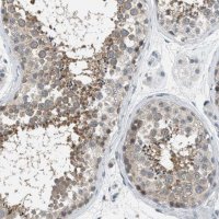 Anti-TTBK2 antibody produced in rabbit 