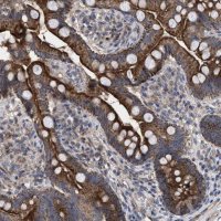 Anti-TTC19 antibody produced in rabbit 