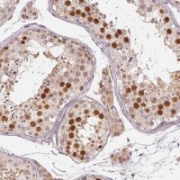 Anti-TTC23L antibody produced in rabbit 