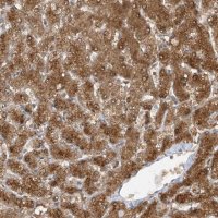 Anti-TTC38 antibody produced in rabbit 