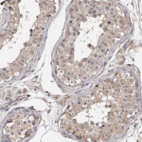 Anti-TTC39A antibody produced in rabbit 