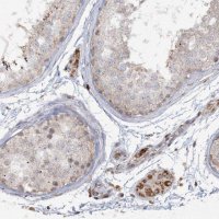 Anti-TTC7A antibody produced in rabbit 