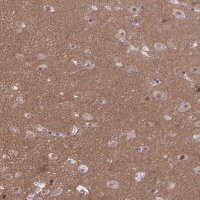 Anti-TTC7B antibody produced in rabbit 