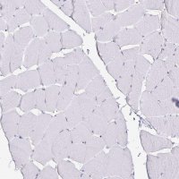Anti-TTR antibody produced in rabbit HPA002550-100UL