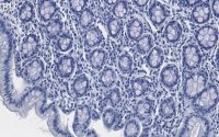 Anti-Tubulin -2 Antibody, clone 1M19 ZooMAb Rabbit Monoclonal 