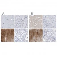 Anti-TXLNB antibody produced in rabbit 