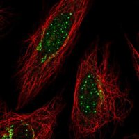 Anti-TYMP antibody produced in rabbit 