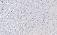 Anti-Tyrosine Hydroxylase Antibody, clone 20/40/15 ZooMAb Mouse Monoclonal 