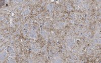 Anti-Tyrosine Hydroxylase Antibody, clone 3M12, ZooMAb Rabbit Monoclonal 