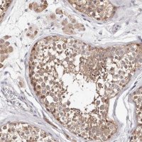 Anti-TYW3 antibody produced in rabbit 