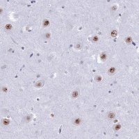 Anti-U2AF1 antibody produced in rabbit 