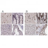 Anti-U2SURP antibody produced in rabbit 