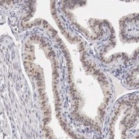 ANTI-UBA1 antibody produced in rabbit HPA000289-100UL