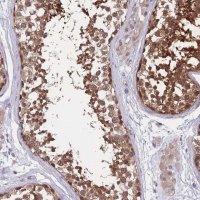 Anti-UBE2N antibody produced in rabbit 